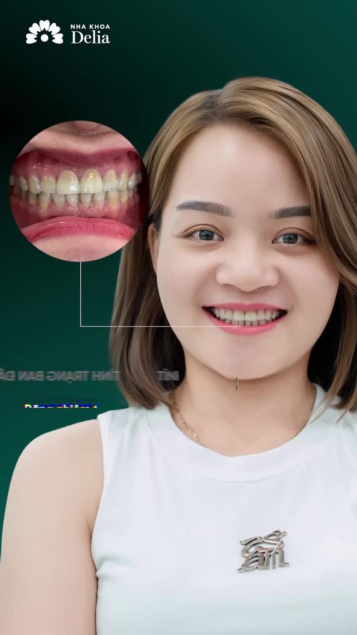 KHOẢN ĐẦU TƯ XỨNG ĐÁNG CHO NỤ CƯỜI RẠNG RỠ