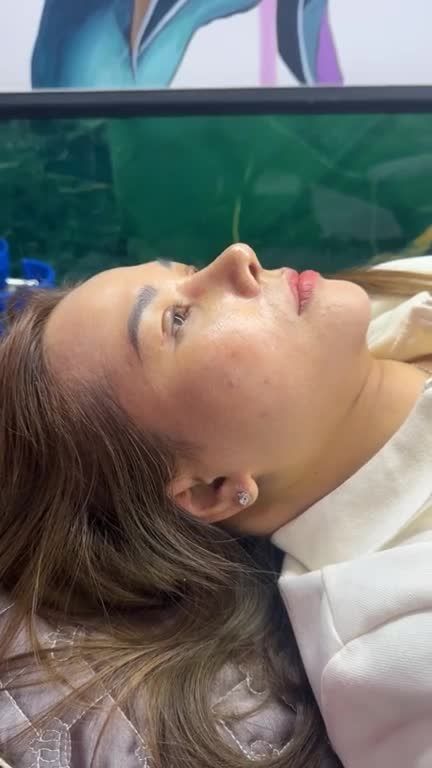 Mũi cấu trúc sửa lại