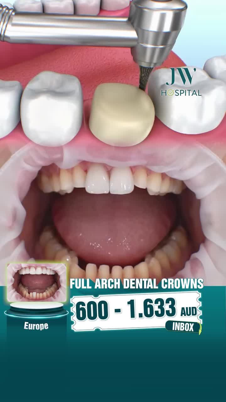 THOÁT NỖI ÁM ẢNH MẤT RĂNG, QUÝ CÔ U60 NGƯỜI ÚC CƯỜI RẠNG RỠ, TỰ TIN SAU BỌC RĂNG SỨ TẠI JW