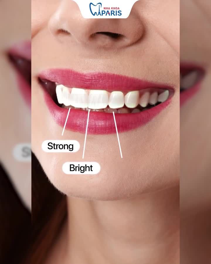RĂNG NHIỄM TETRACYCLINE: ĐỪNG TẨY TRẮNG VÔ ÍCH – BỌC SỨ ĐỔI VẬN NGAY!
