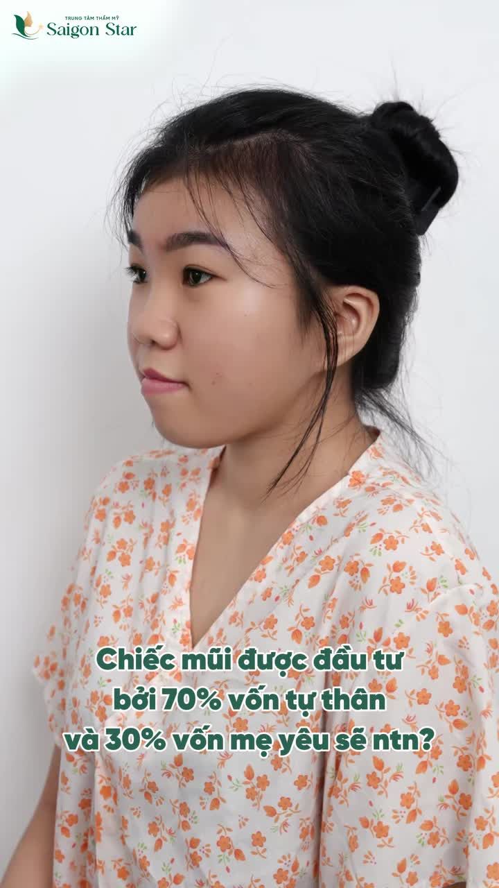 Chiếc mũi này được đầu tư theo tỷ lệ: 70% vốn tự thân 30% tài trợ từ mẹ yêu