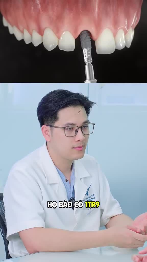 Trồng implant chỉ có 1tr9 thì có an toàn hay không?