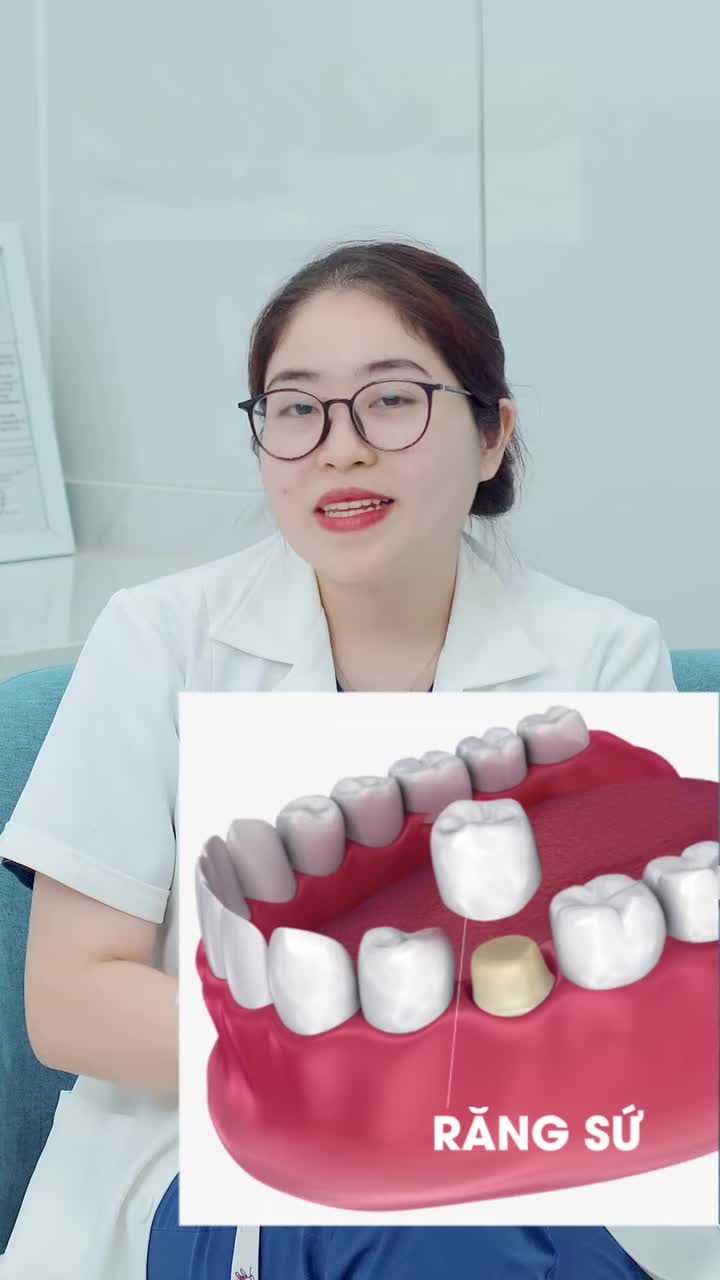 Bị mất men răng nên bọc sứ hay dán sứ veneer???