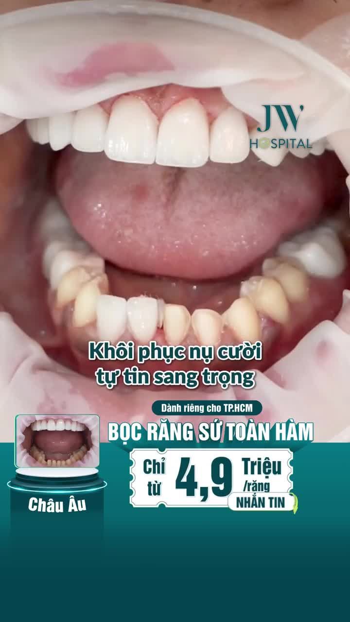 NGƯỜI SÀI GÒN NGẠI CƯỜI VÌ RĂNG Ố VÀNG, THƯA KẼ?