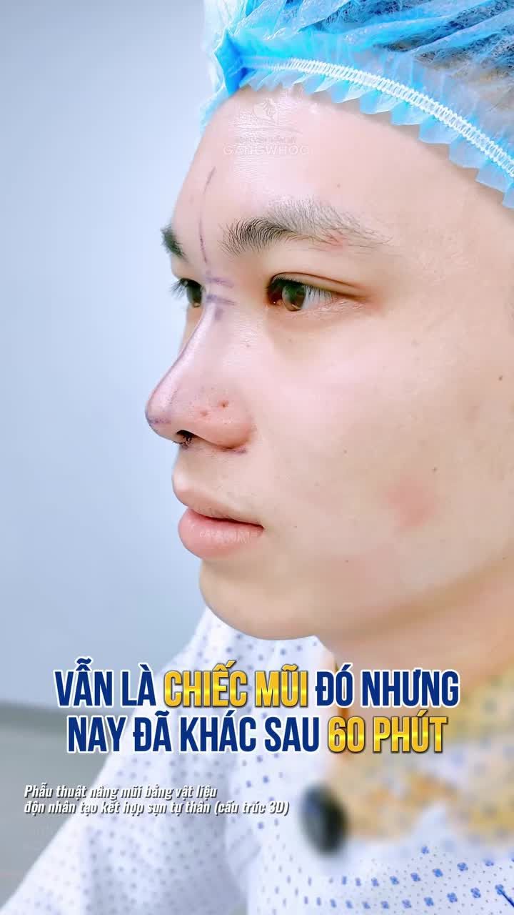 Vẫn là chiếc mũi đó nhưng nay đã khác sau 60 phút