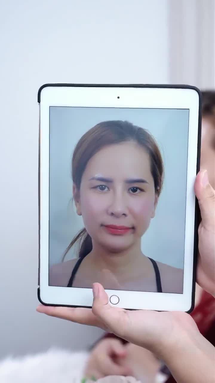KẾT QUẢ SAU 10 NGÀY TRẺ HÓA TOÀN DIỆN CÙNG COMBO: