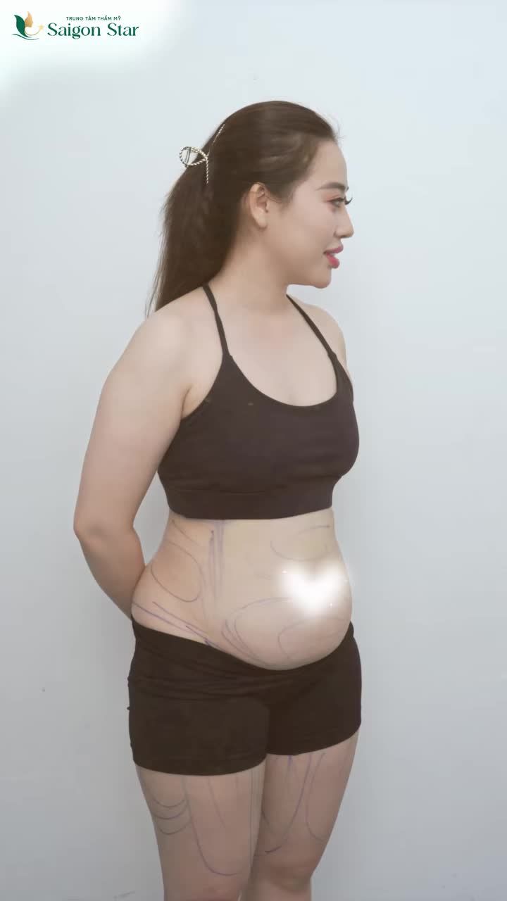 CÔ BA OANH VÀ MÙA HÈ "ĐỐT MẮT" SAU 1 NĂM HÚT MỠ