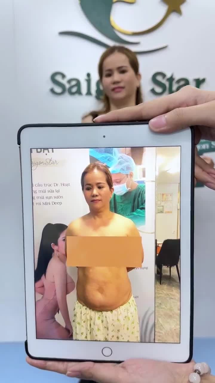 15 ngày HÚT MỠ BỤNG CĂNG DA