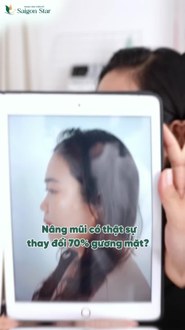 NÂNG MŨI CÓ THẬT SỰ THAY ĐỔI 70% GƯƠNG MẶT?