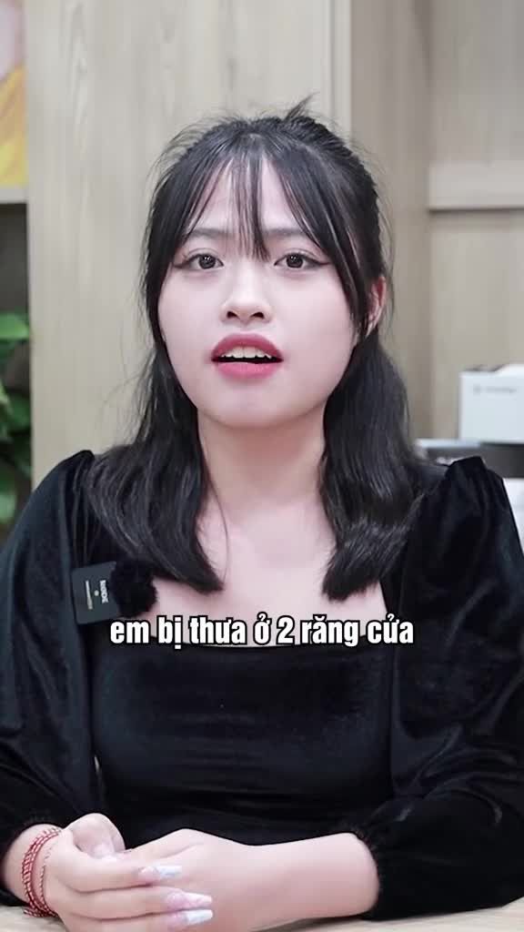 Update phiên bản mới sau niềng răng thưa tại Viet Smile