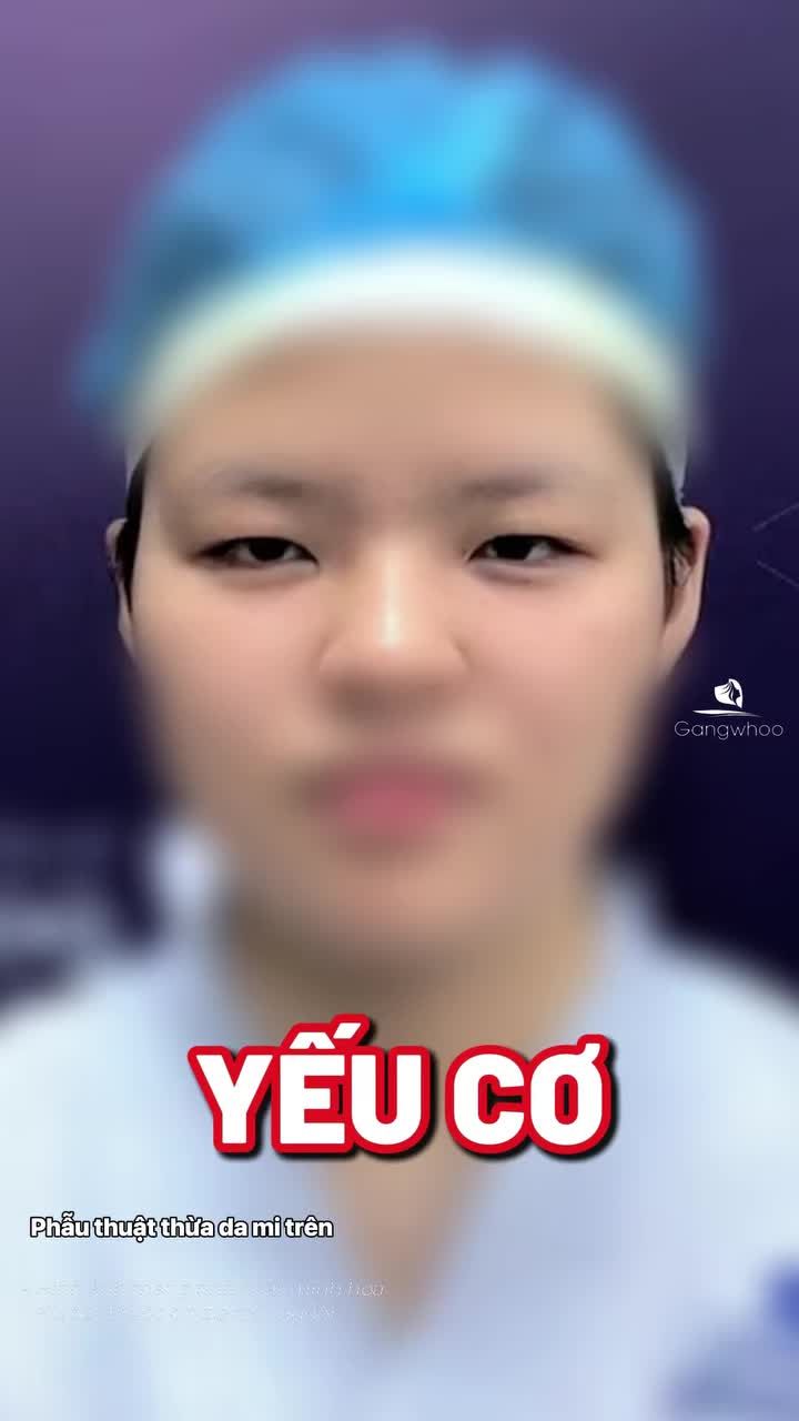 Có thể bạn chưa biết, mắt nhỏ, mắt một mí không chỉ ảnh hưởng đến thẩm mỹ mà còn khiến tầm nhìn bị thu hẹp hơn bình thường.