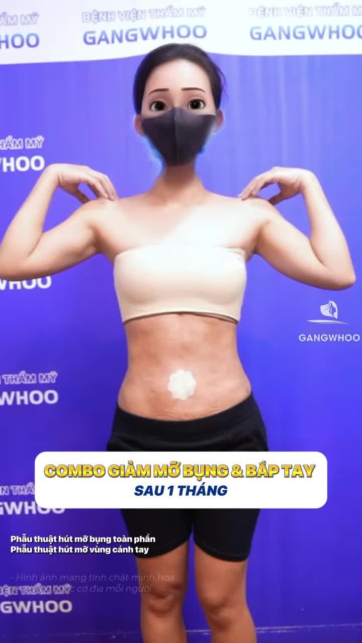 Combo giảm mỡ bụng bắp tay giúp body cân đối, săn gọn
