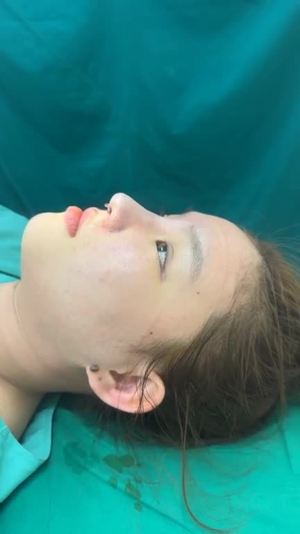 MŨI CẤU TRÚC SỬA LẠI – MỘT LẦN CHỈNH SỬA, MỘT LẦN LẤY LẠI SỰ TỰ TIN