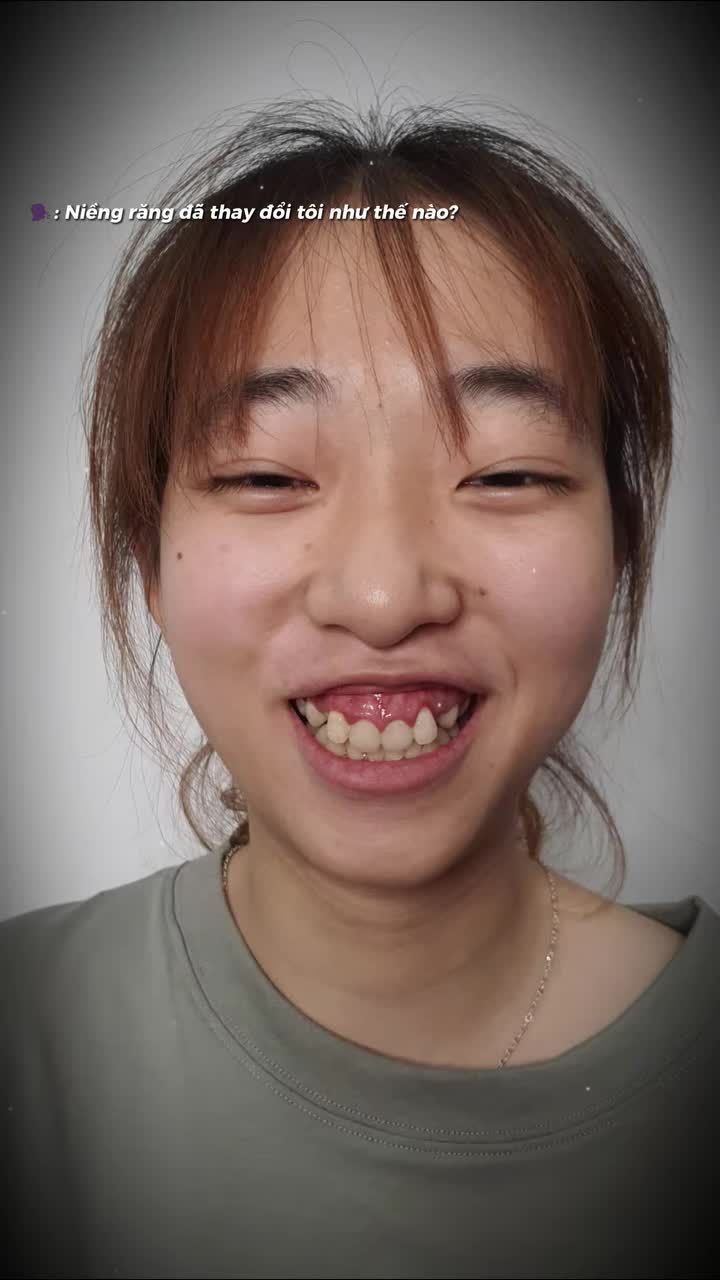 NIỀNG RĂNG ĐÃ THAY ĐỔI TÔI NHƯ THẾ NÀO?