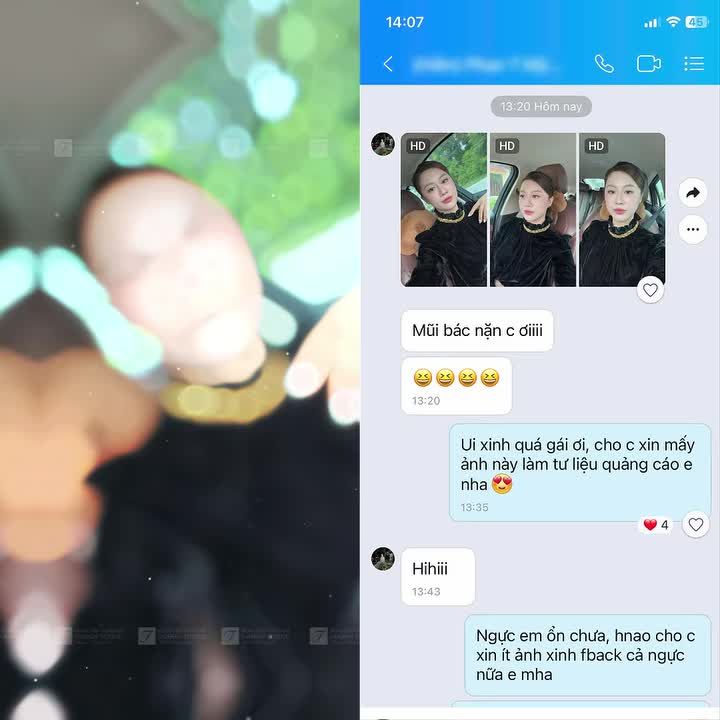 Feedback thực tế từ khách hàng đã được Bác sĩ Tươi "nặn" dáng mũi siêu tự nhiên nhưng khó lòng rời mắt
