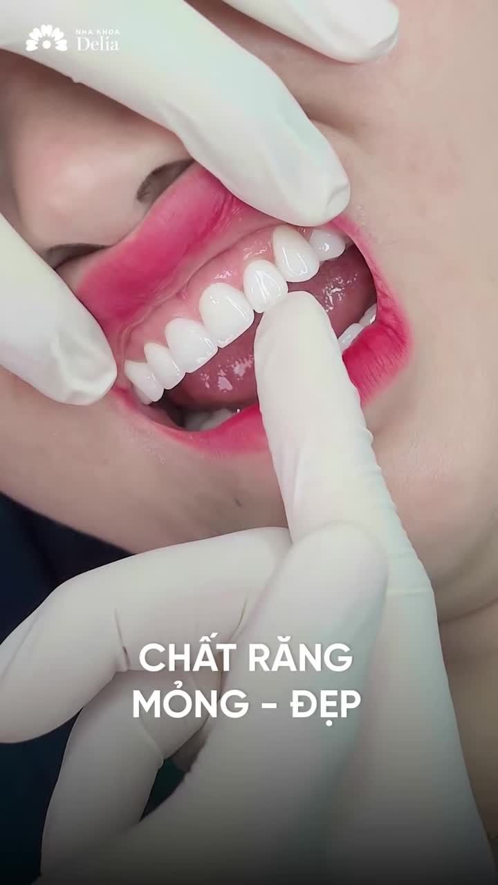 ĐẦU TƯ CHO NỤ CƯỜI 3 NĂM TRƯỚC VÀ "KHOẢN LỢI NHUẬN" VÔ GIÁ Ở HIỆN TẠI!