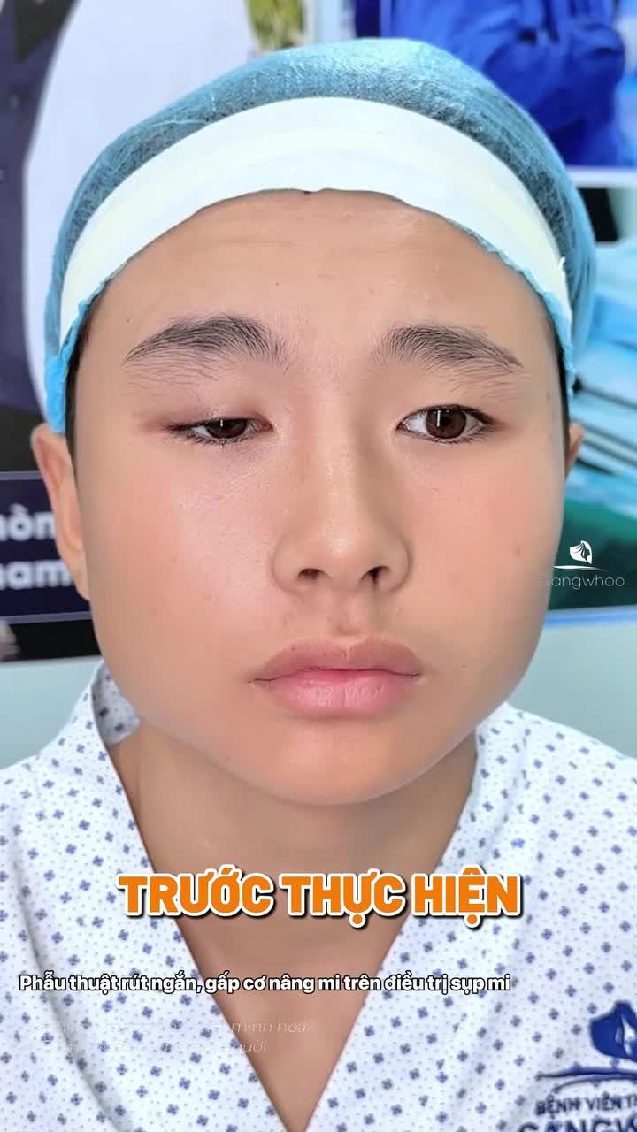 Mẹ vỡ òa trong hạnh phúc khi thấy con trai 14 tuổi phẫu thuật chỉnh sụp mí thành công.