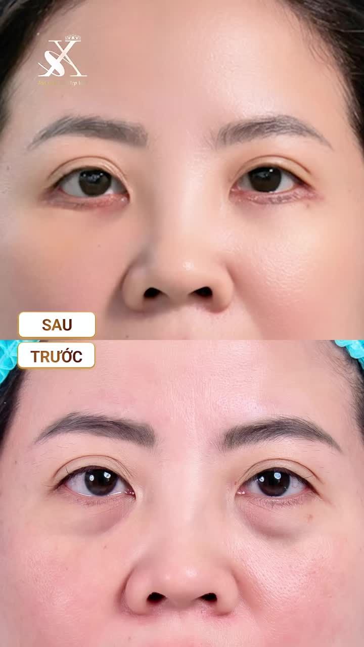 "VỀ NHÀ THẤY HẾT BỌNG MỠ GIẬT MÌNH LUÔN!"