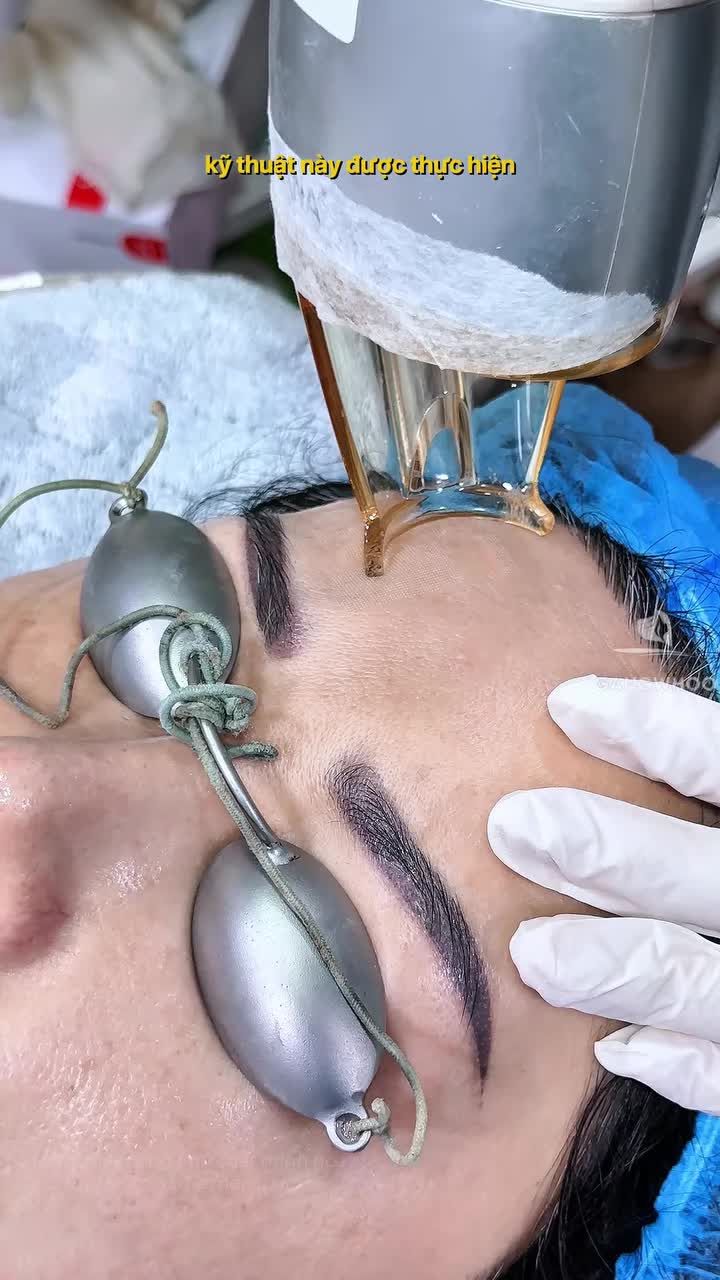 Trẻ hóa làn da với công nghệ Laser Fractional Co2 chỉ 5.5tr
