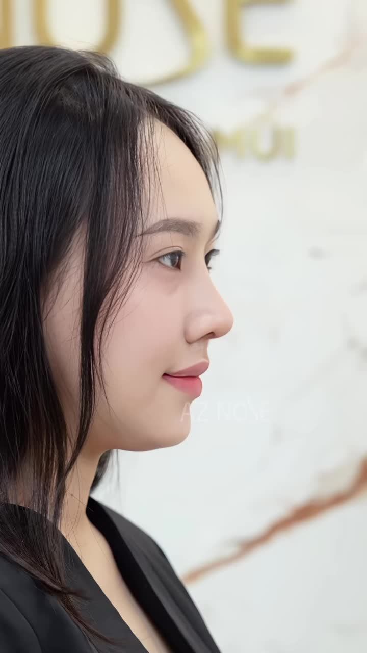 Có những thay đổi chỉ vài milimet nhưng đủ để góc nghiêng khác đi, thần thái khác đi và sự tự tin cũng khác đi.
