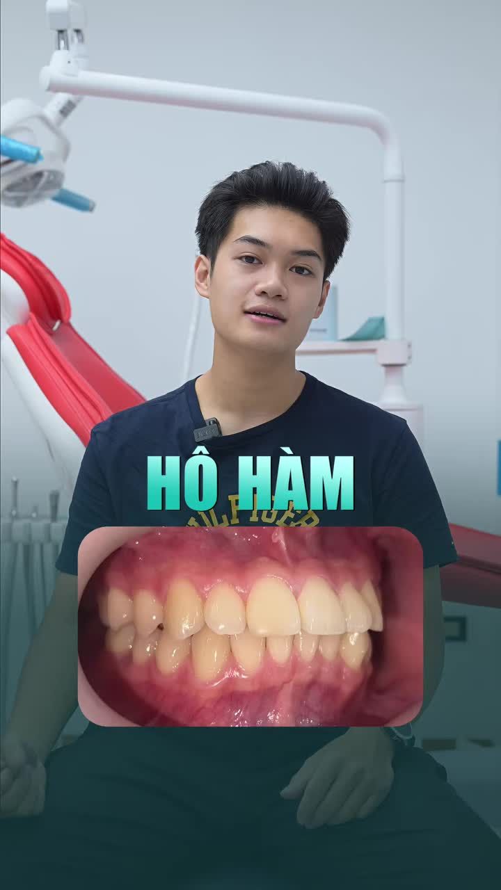 Lý do chàng sinh viên Học viện Ngoại giao chọn Nha khoa Quốc tế Việt Đức để niềng răng?