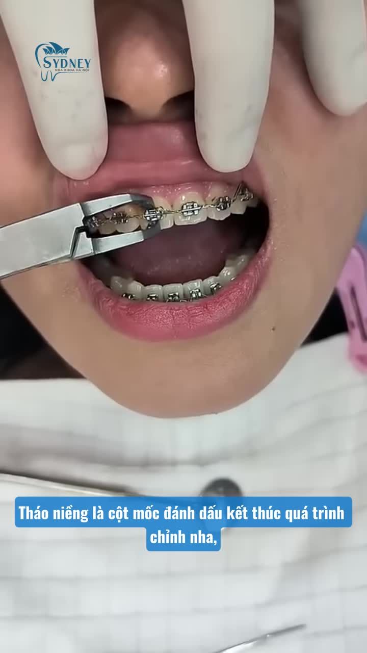 SAU THÁO NIỀNG CẦN ĐEO HÀM DUY TRÌ TRONG BAO LÂU?