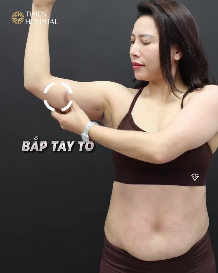 Màn thăng hạng nhan sắc sau Hút Mỡ của Á Hậu Hồng Mến!