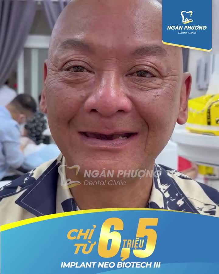 Xem thêm 23 video Trồng Răng Implant của bác sĩ Bs nha khoa Ngân Phượng