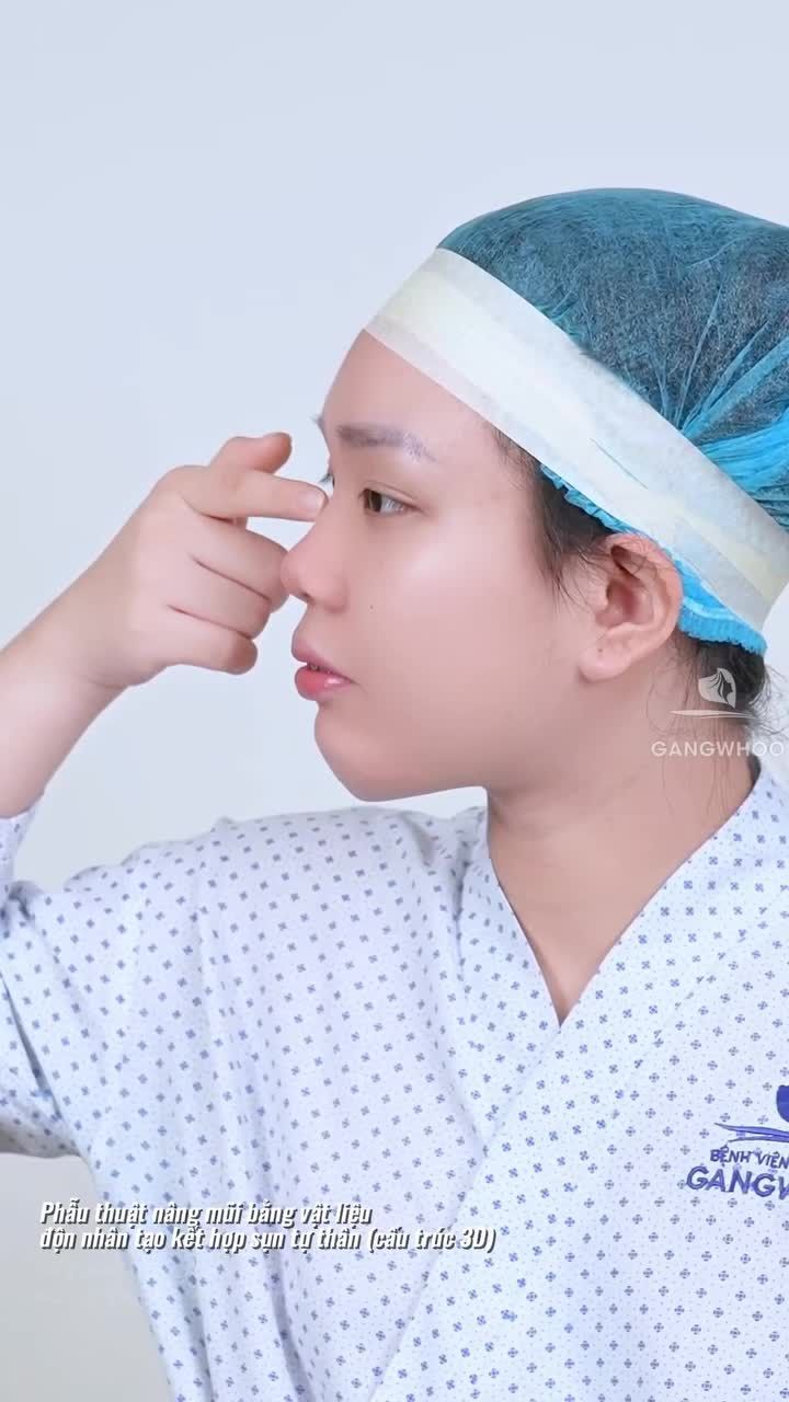 Gangwhoo ơi, em muốn một chiếc mũi cao hơn, đẹp hơn và đây là thành quả