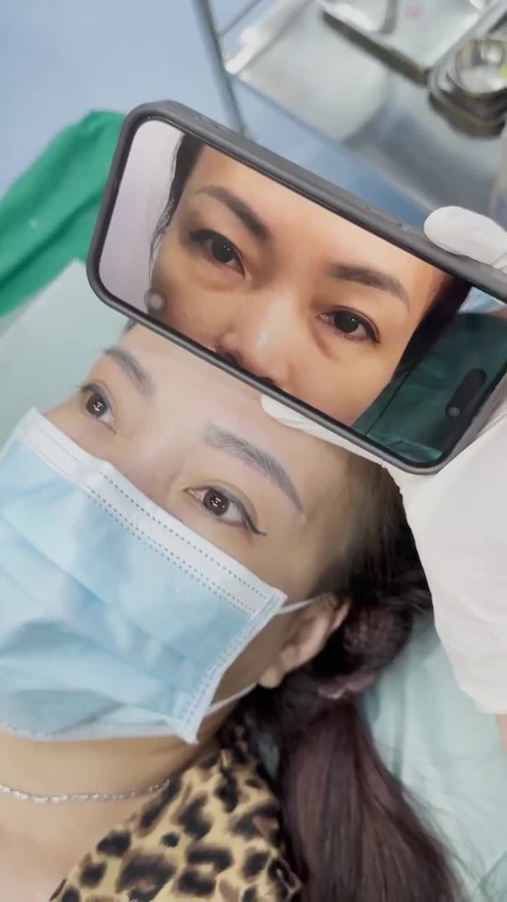 20 NGÀY TRẺ HÓA CÙNG TREO CUNG CHÂN MÀY
