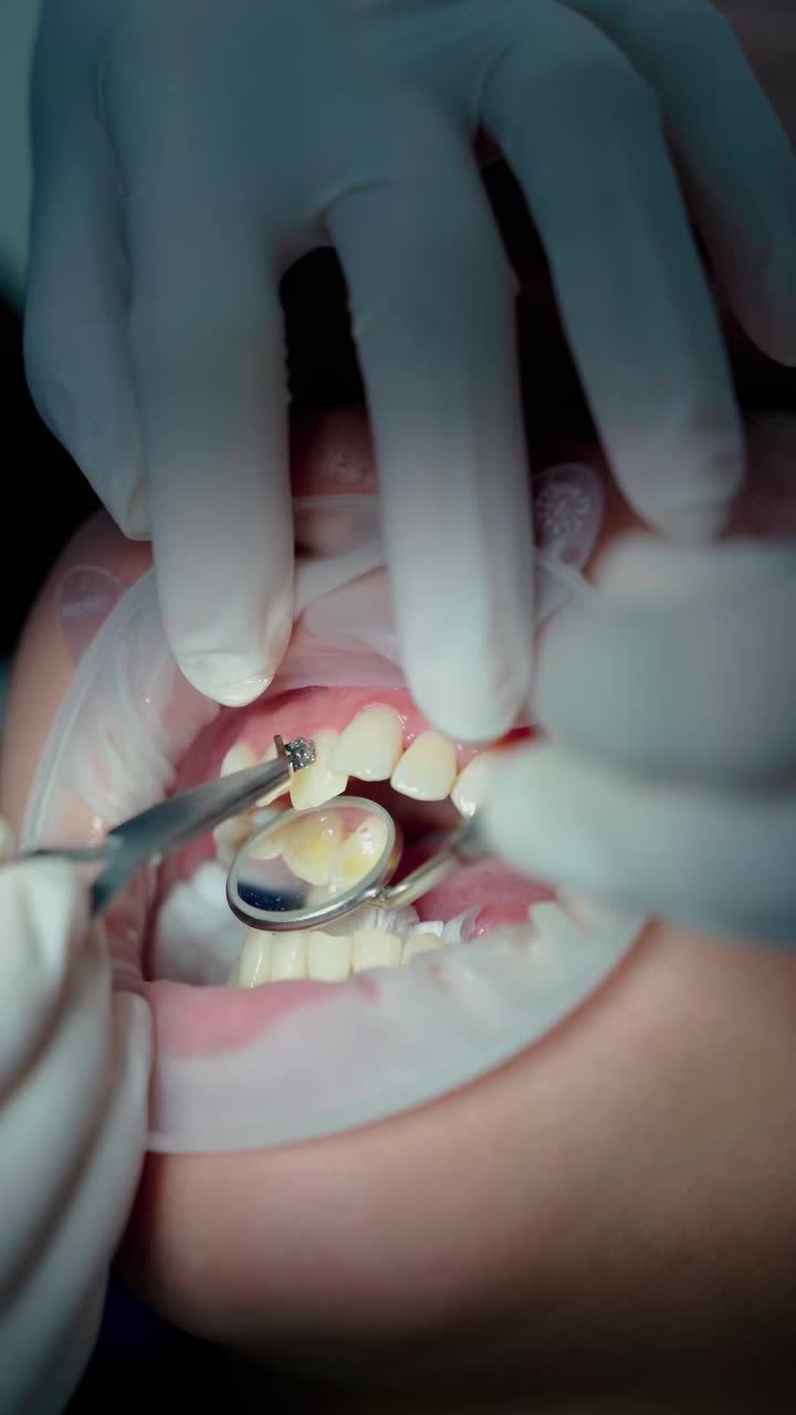 BÁC SĨ GẮN MẮC CÀI NIỀNG RĂNG CHO KHÁCH HÀNG ĐẶNG THỊ QUYÊN