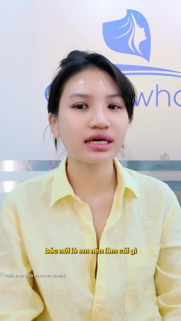 Tin tưởng tay nghề của bác sĩ và cái kết sở hữu đôi mắt hai mí như mơ ước