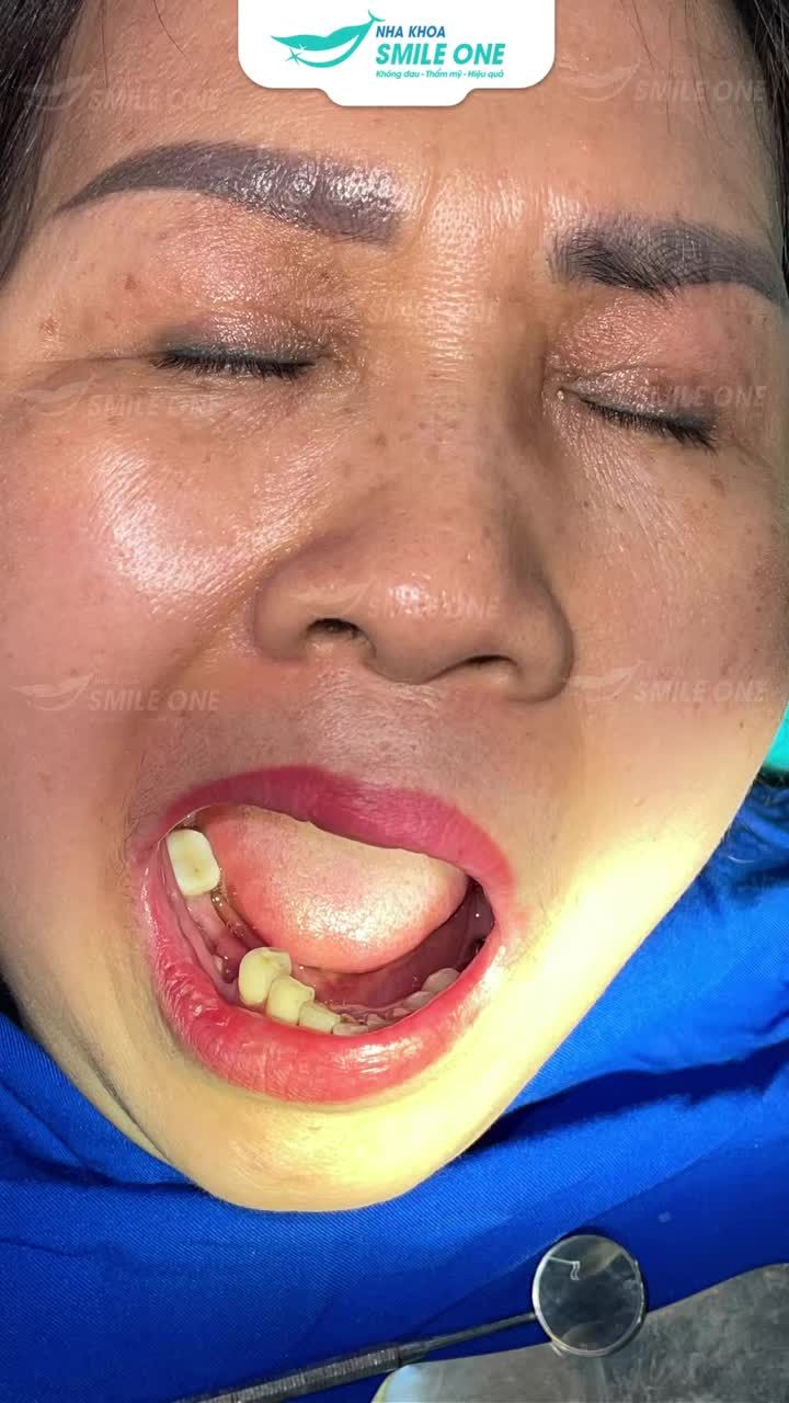 "ĐIỀU TÔI HÀI LÒNG NHẤT LÀ ĐÃ KHÔNG CÒN NGẠI ĂN UỐNG."