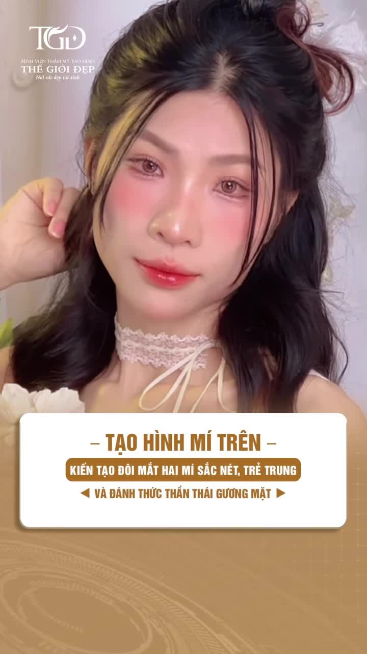 Tạo hình mí trên – Kiến tạo đôi mắt hai mí sắc nét, trẻ trung và đánh thức thần thái gương mặt