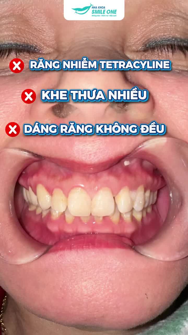 ĐẸP KHÔNG PHẢI LÀ TRẮNG NHẤT. MÀ LÀ PHÙ HỢP NHẤT.
