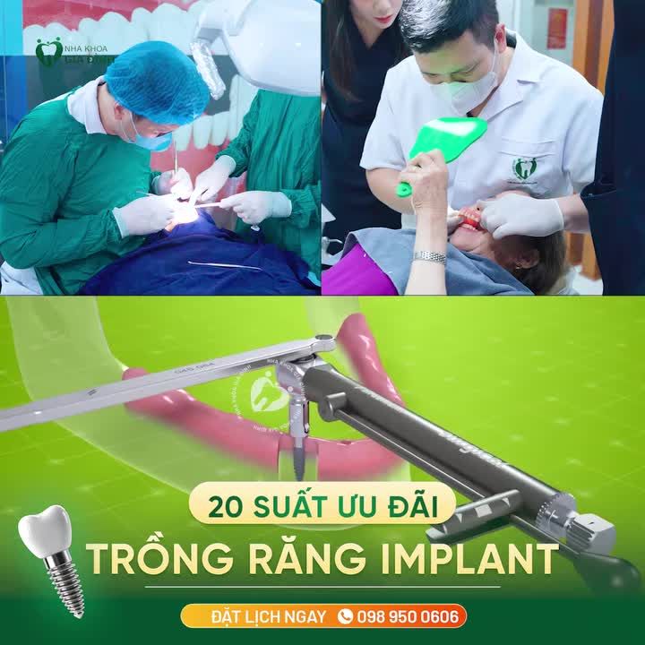 CHỈ CÒN 20 SUẤT ƯU ĐÃI ĐẶC BIỆT TRỒNG RĂNG IMPLANT TOÀN HÀM CHỈ TỪ 35 TRIỆU ĐỒNG