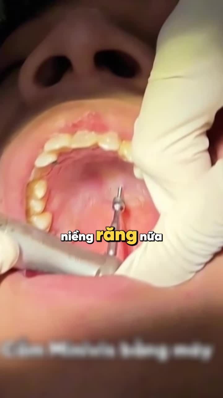 THỦ THUẬT NÀO KHIẾN "ĐỒNG NIỀNG" SỢ NHẤT?