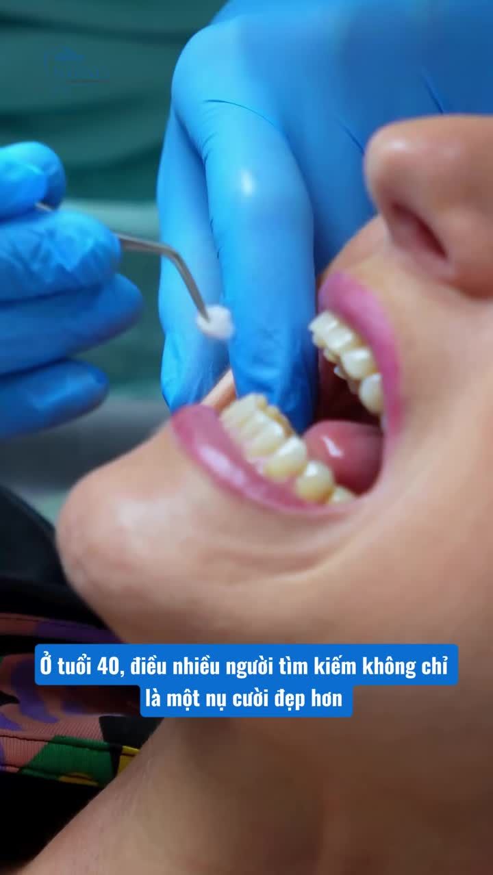 40 Tuổi có nên niềng răng không?