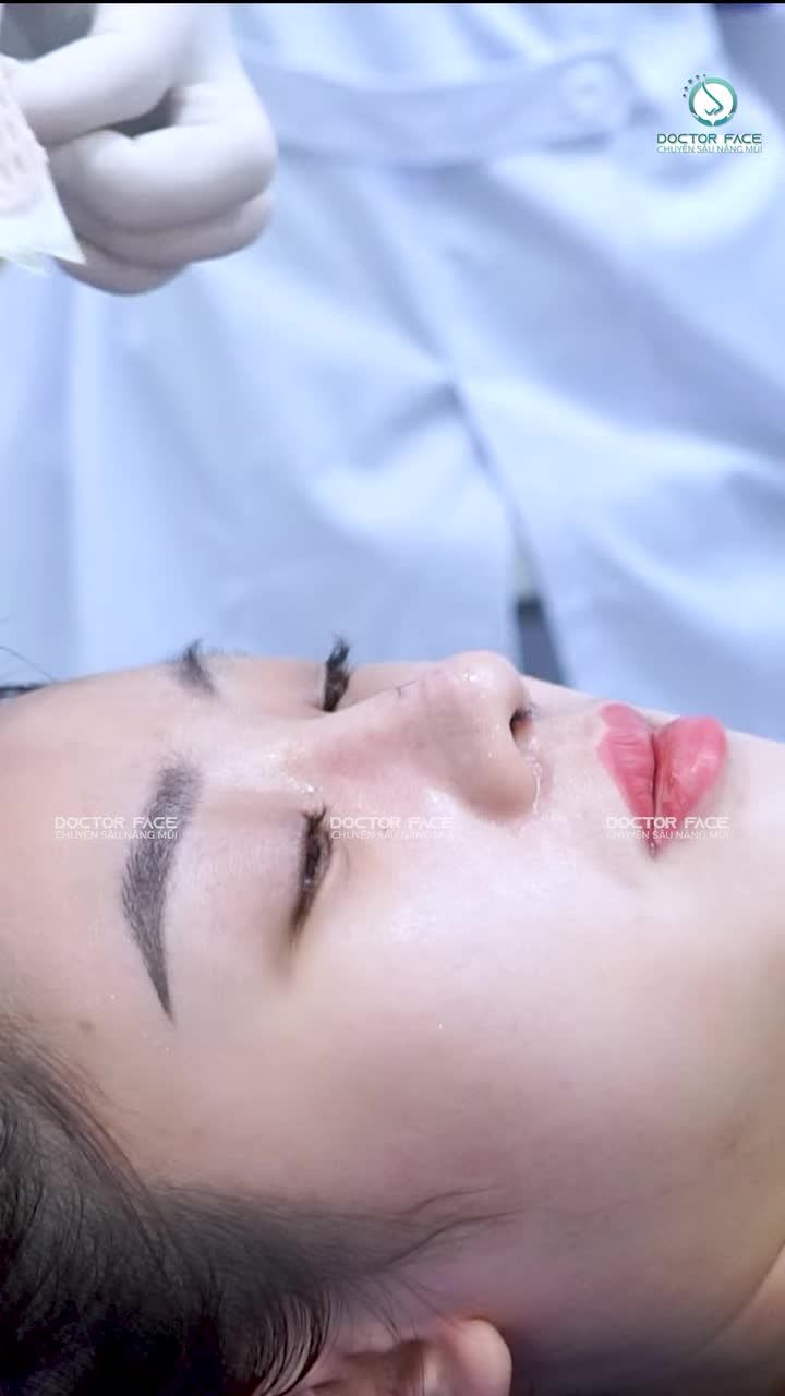 Có lẽ đây là khoảnh khắc được mong chờ nhất sau nâng mũi.