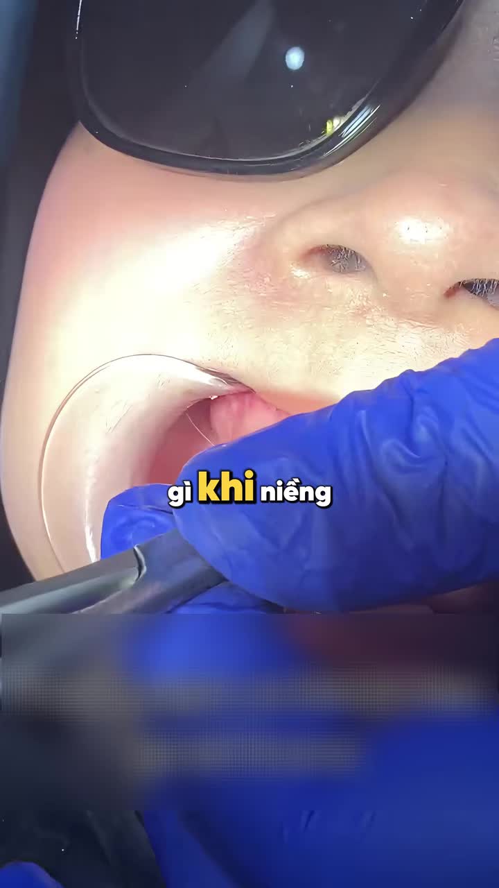 NHỮNG ĐIỀU KHÔNG AI NÓI CHO BẠN TRƯỚC KHI NIỀNG