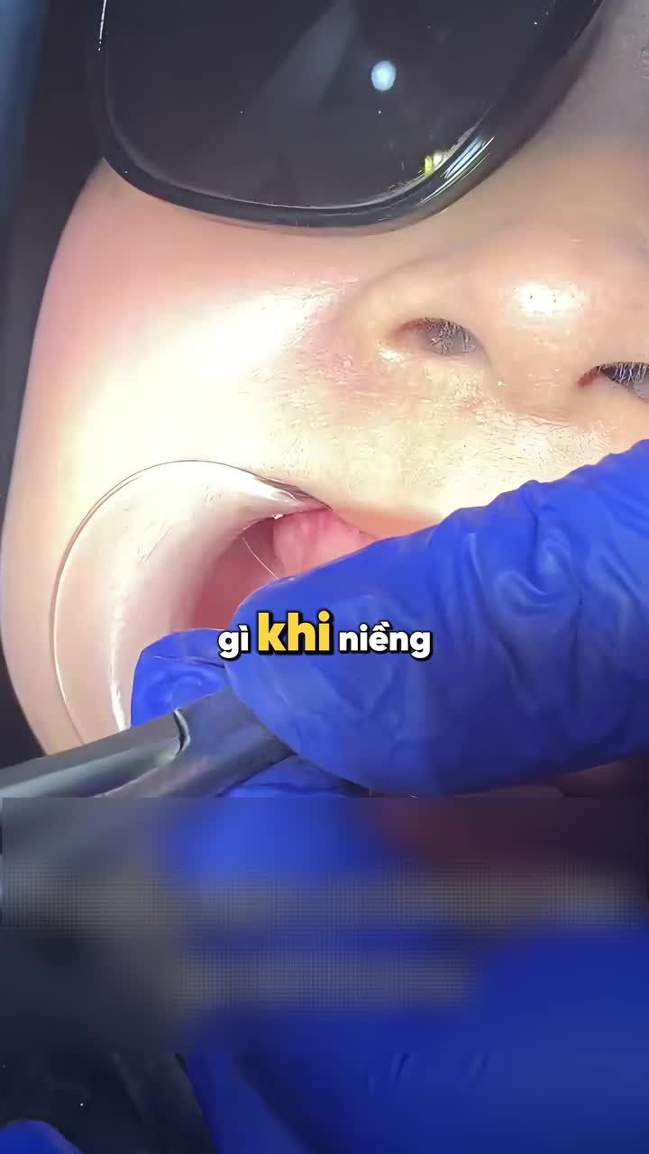 NHỮNG ĐIỀU KHÔNG AI NÓI CHO BẠN TRƯỚC KHI NIỀNG