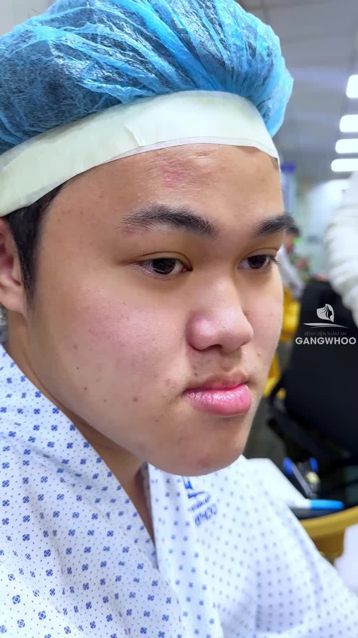 Một ca hàm "lưỡi cày" được hội chuẩn phân tích chuyên sâu cùng Ekip Bác sĩ Gangwhoo để đưa ra phương án thực hiện cân đối hài hòa với khách hàng.