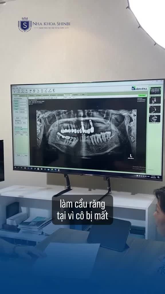 "LÀM CẦU RĂNG 2-3 BỮA LẠI GÃY, TƯỞNG SỐ MÌNH KHỔ VỚI CÁI RĂNG..."