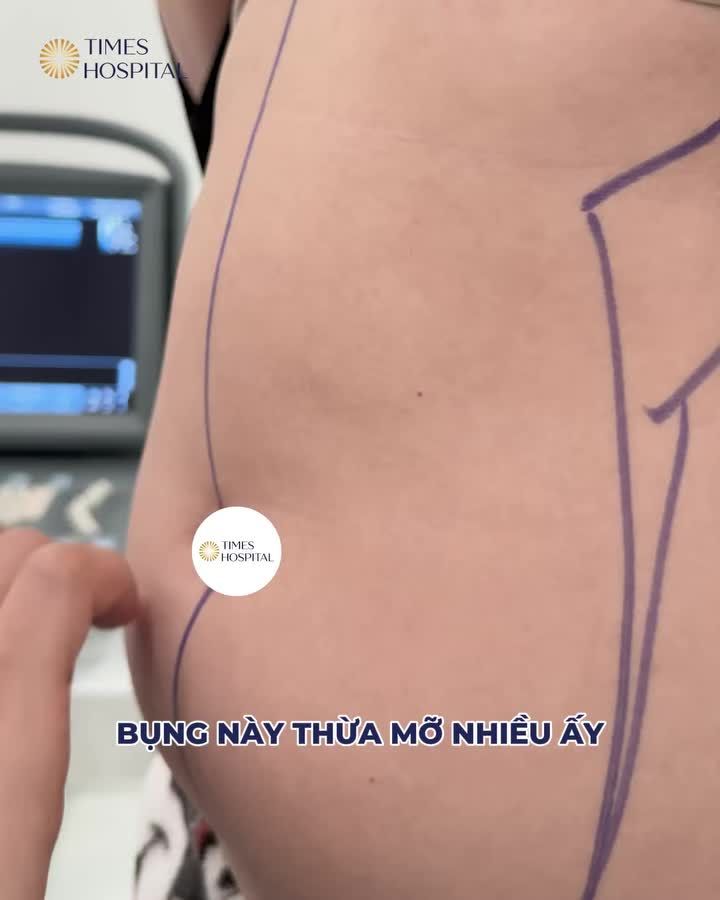 TÁI SINH VÒNG 2 CỦA MẸ BỈM 2 CON