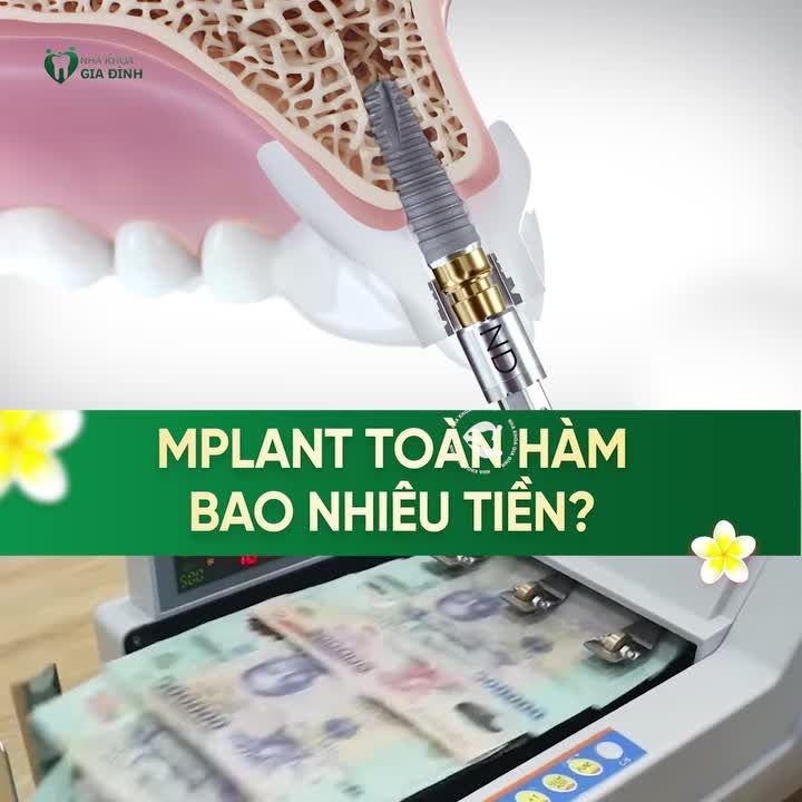 TRỒNG RĂNG IMPLANT TOÀN HÀM GIÁ BAO NHIÊU TIỀN?
