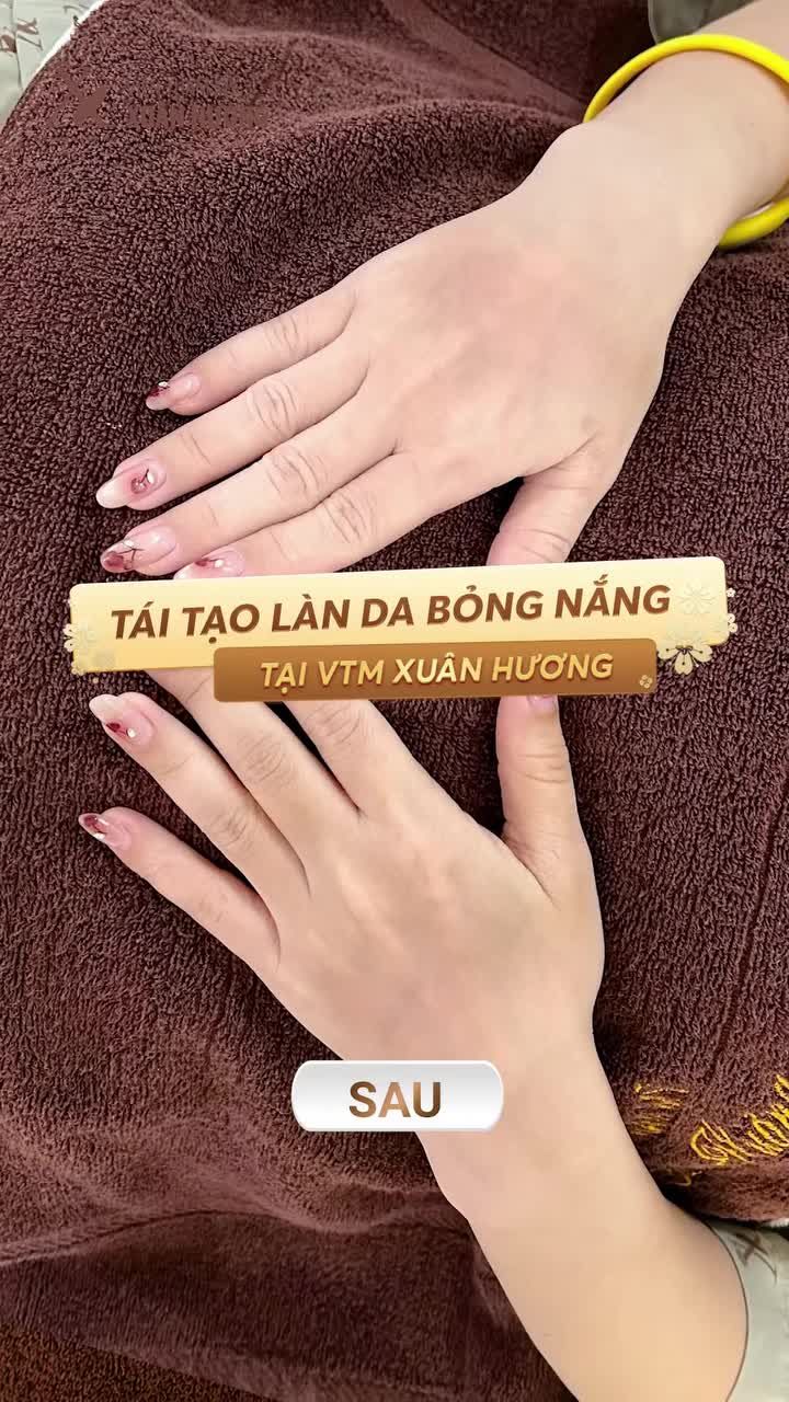 HỒI PHỤC LÀN DA BỊ BỎNG NẮNG NGAY TỨC THÌ