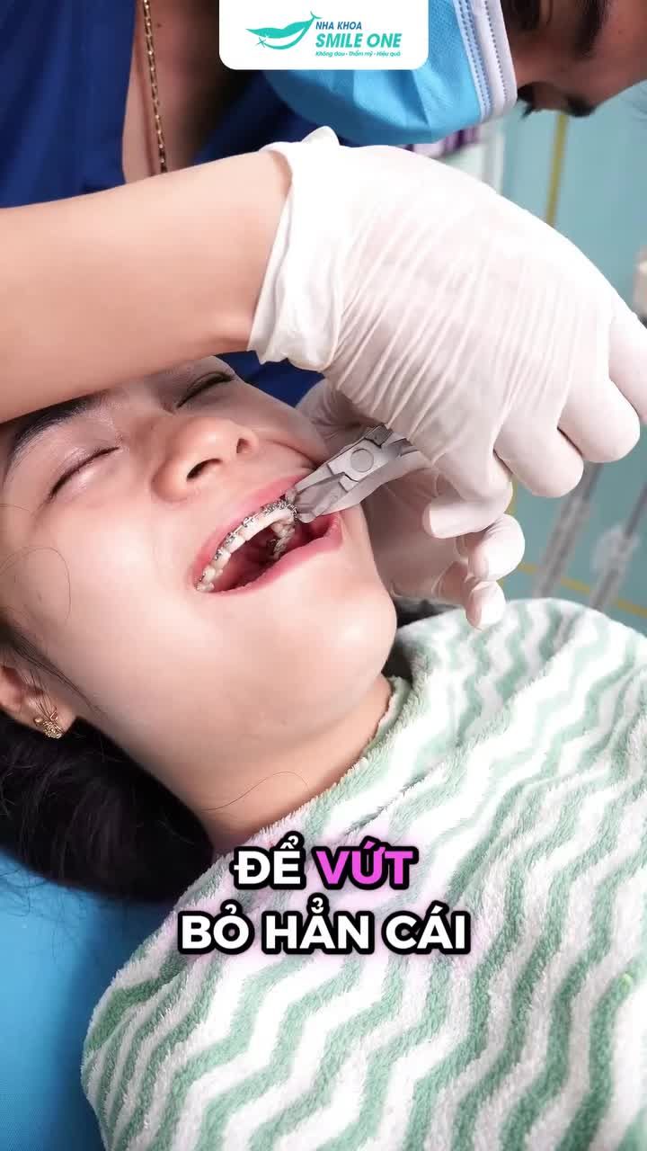 THÁO NIỀNG KHÔNG CÓ NGHĨA LÀ ĐƯỢC "CHIA TAY" HÀM DUY TRÌ!