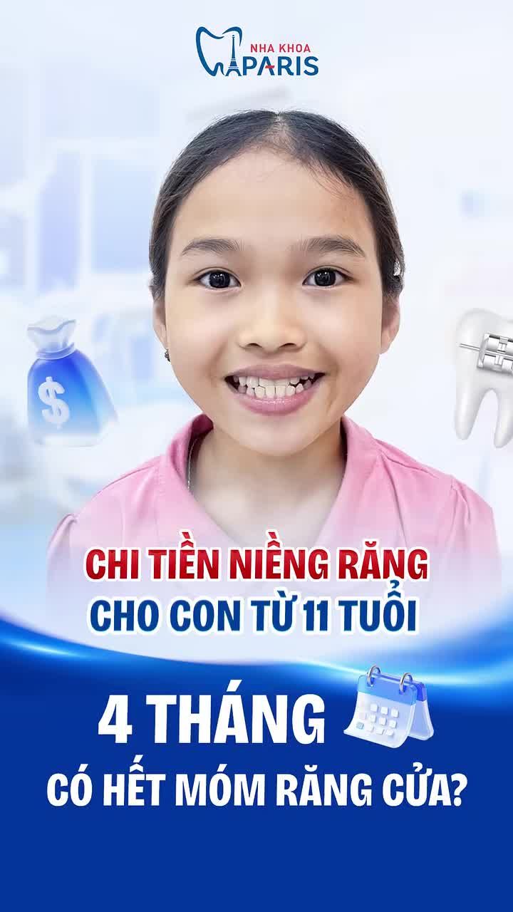 CHI TIỀN NIỀNG RĂNG CHO CON TỪ 11 TUỔI – BÀI TOÁN ĐẦU TƯ TỐI ƯU CỦA BA MẸ SÁNG SUỐT!