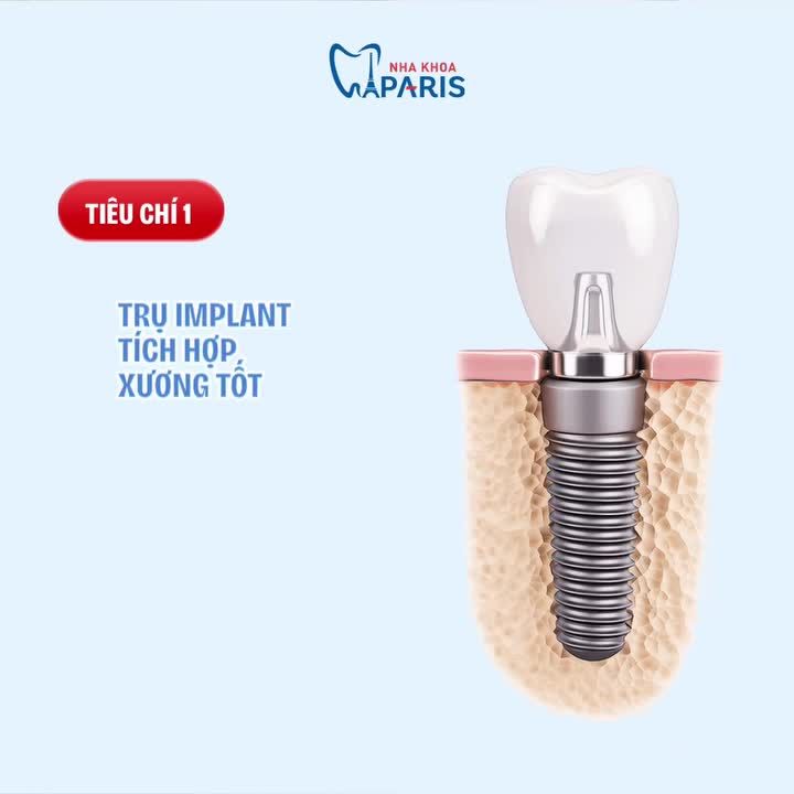 4 THƯỚC ĐO VÀNG ĐÁNH GIÁ 1 CA TRỒNG IMPLANT THÀNH CÔNG