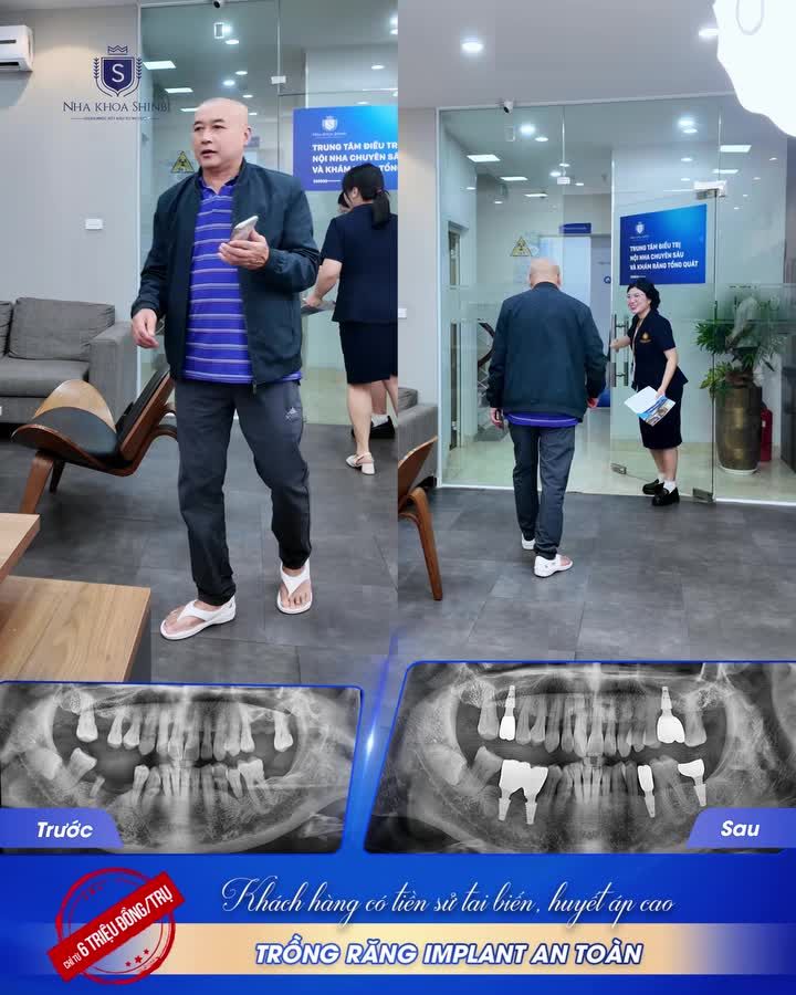 SỰ THẬT Y KHOA: Người Từng Bị Tai Biến Có Trồng Được Răng Implant Không? "ĂN ĐƯỢC, NHAI ĐƯỢC, HẤP THU ĐƯỢC DINH DƯỠNG THÌ CƠ THỂ MỚI KHỎE LÊN ĐỂ TẬP LUYỆN ĐƯỢC..."